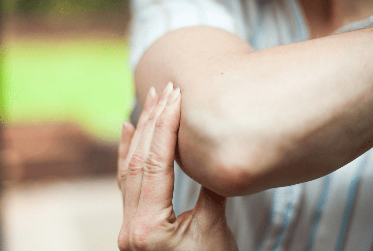 Cubital Tunnel Syndrome (Ulnar nerve compression) - Perth